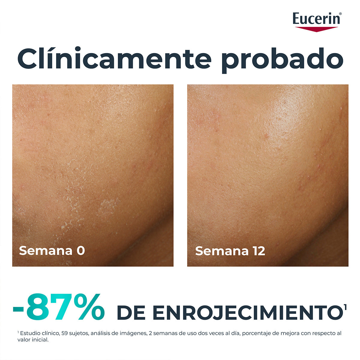 EUCERIN DERMOPURE HYDRAREPAIR 40ML